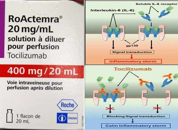 Tocilizumab Drug for Covid-19